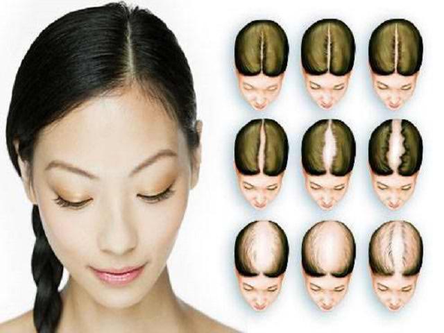 Почему выпадают волосы на голове у женщин, причины и лечение